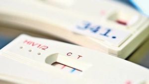 „Die Schwelle zum HIV-Test wird geringer“